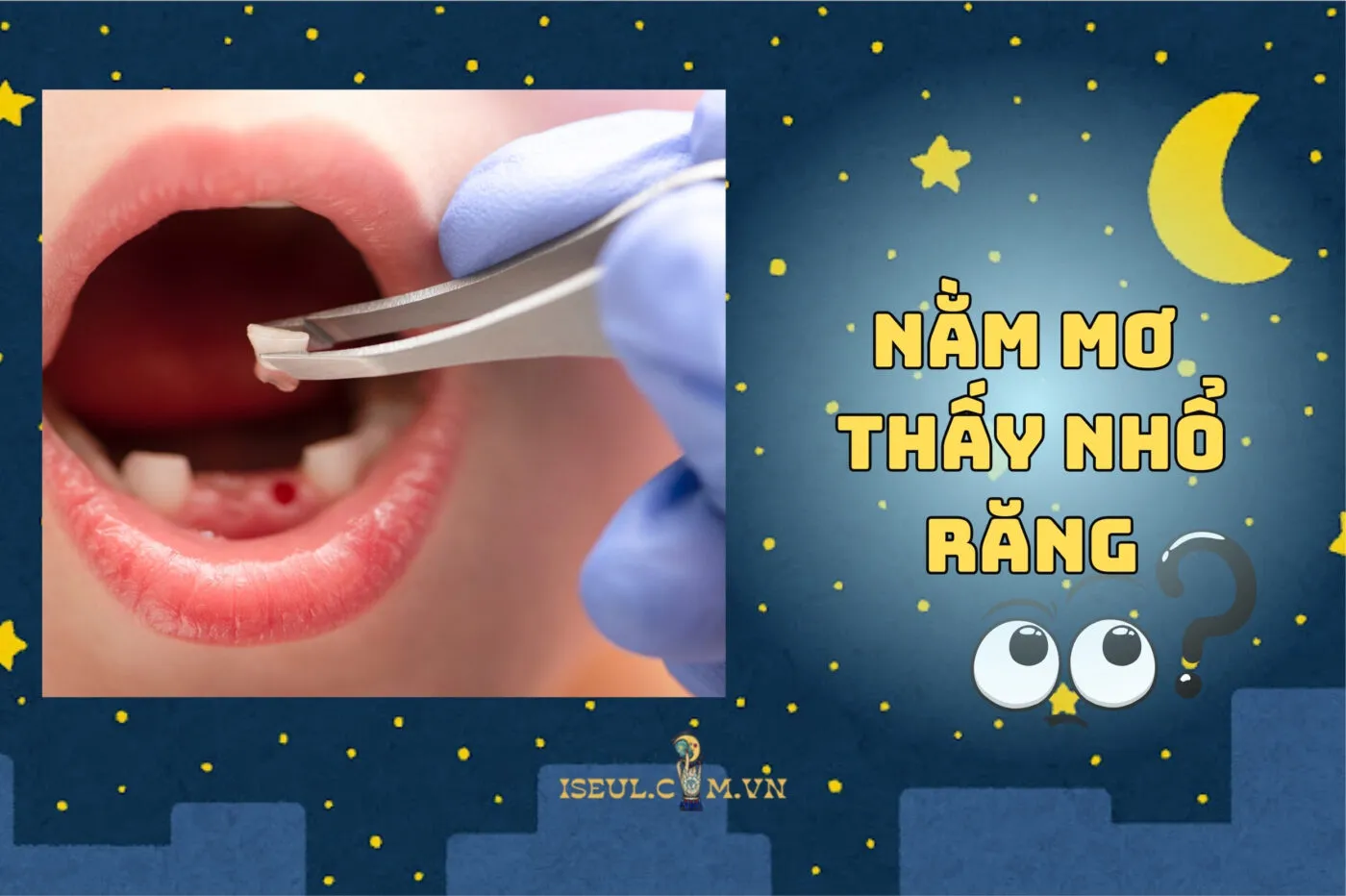 Giải mã nằm mơ thấy nhổ răng có ý nghĩa gì? Xấu hay tốt 2025?