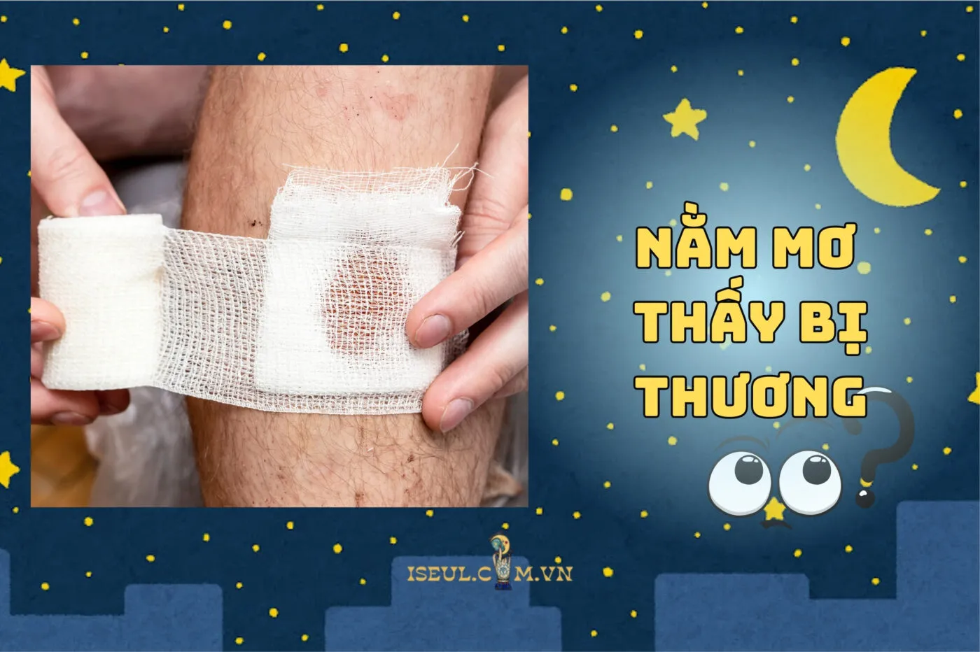 Nằm Mơ Thấy Bị Thương: Hé Lộ Drama Tiềm Thức Cực Hot 2025