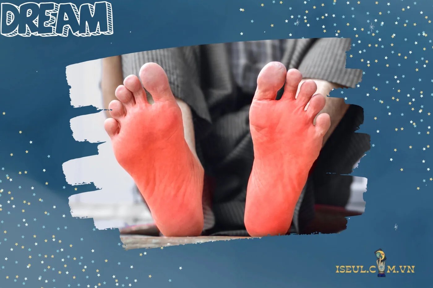 Những mối quan hệ trong giấc mơ thấy bị bỏng