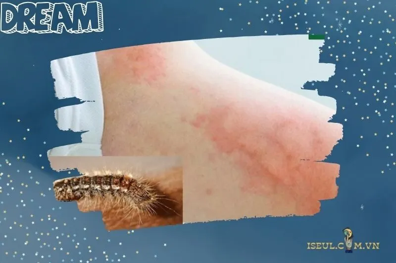 Ý nghĩa giấc mơ thấy sâu bọ là gì?