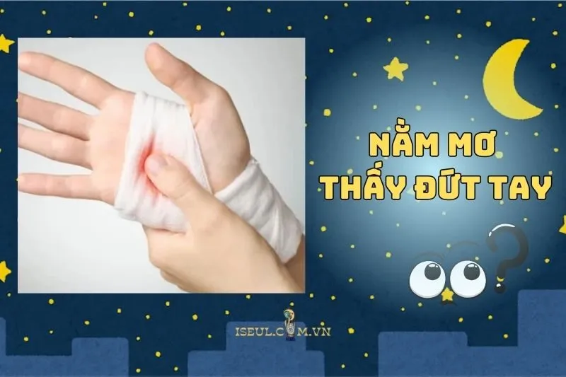 Bạn nằm mơ thấy đứt tay? Khám phá ngay ý nghĩa sâu xa 2025