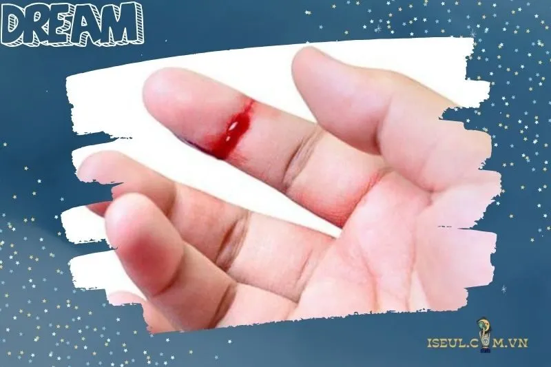 Giấc mơ nằm mơ thấy đứt tay liên quan đến con số nào?