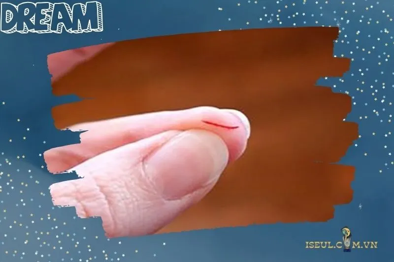 Giải mã ý nghĩa của giấc mơ nằm mơ thấy đứt tay